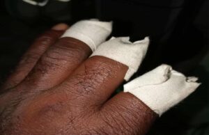 Injured Worker Sues Sethi Ferro Fabrik Over Factory Accident