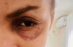 Sudden Death of Sam Jackson’s Wife Sparks National Debate, Police Launch Homicide Probe